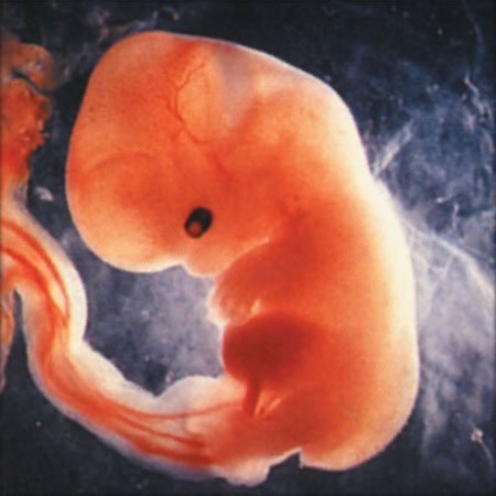 human fetus