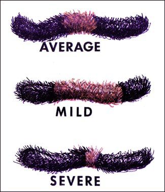 woolly worm chart