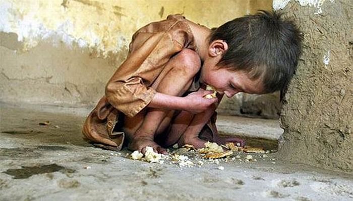 starving child