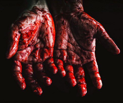 bloody hands