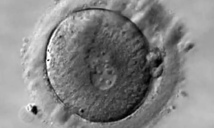 human zygote